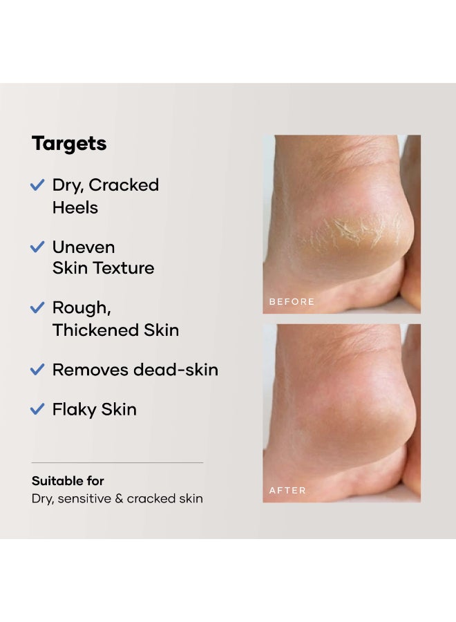 Cureskin كريم العناية بالقدمين للكعوب المتشققة | يصلح، ينعّم، ويقشر | كريم للقدمين للنساء والرجال، 50 جرام (عبوة واحدة) - Image 5